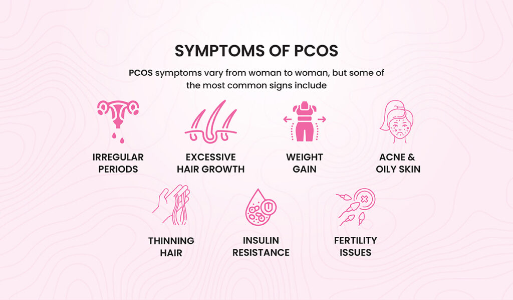 PCOS Explained: What Every Woman Should Know